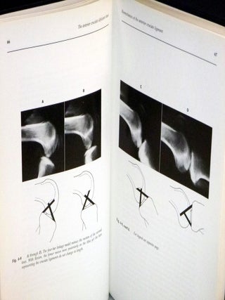 The Anterior Cruciate Deficient Knee: New Concepts in Ligament Repair.